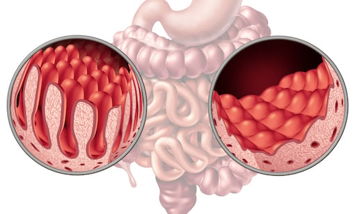 Your Gut Villi