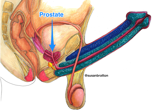 Prostate Spot